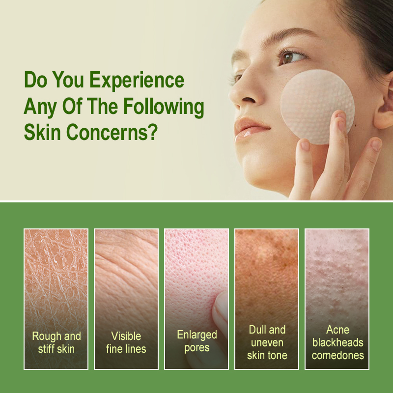 Salicylic Acid Exfoliating Pad - Salicylic Acid Blackhead Remover ulasan dan harga